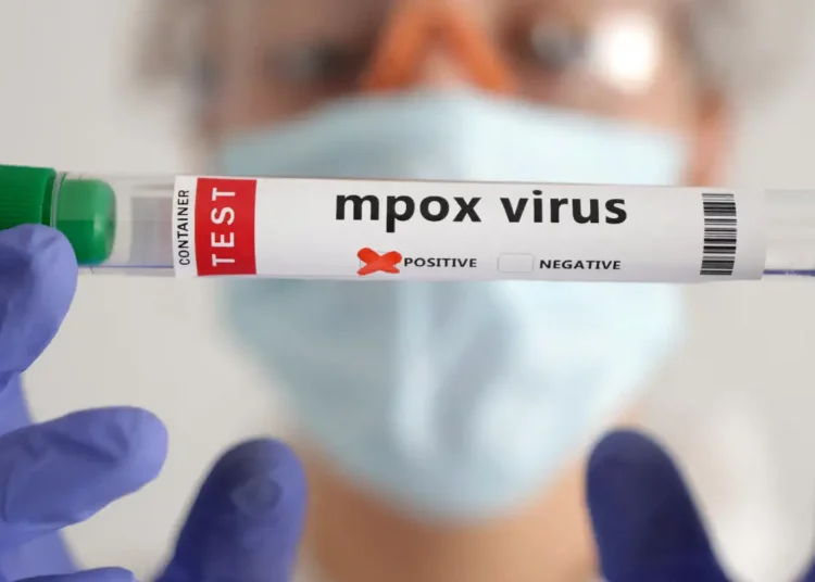 Mpox: África tem quase 50 mil casos confirmados