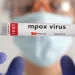 Mpox: África tem quase 50 mil casos confirmados