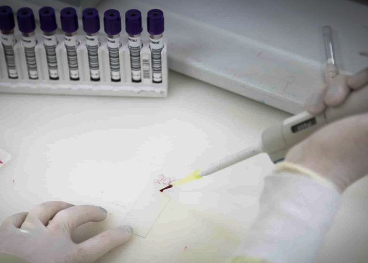 Exames descartam ebola em imigrante da República Democrática do Congo