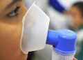 Casos de síndrome respiratória aguda grave estão em queda no país