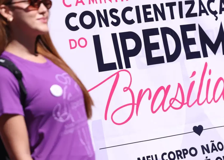 Lipedema: doença crônica vai além da questão estética