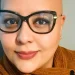 Pacientes com alopecia areata contam trajetória para reaver autoestima